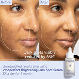 Vinoperfect Brightening Routine for Dark Spots and Uneven Skin Tone