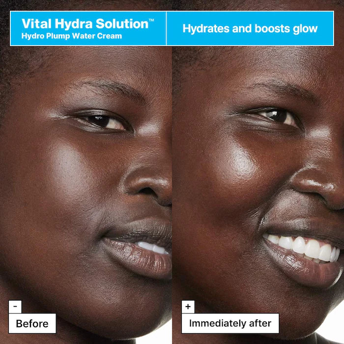 Vital Hydra Solution™ Hyaluronic Acid Gift Set for Glowing Skin