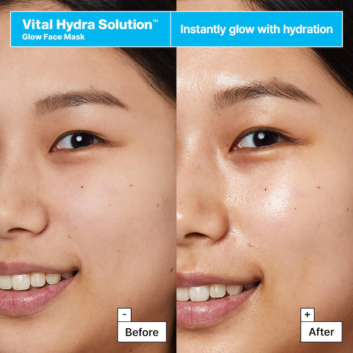 Vital Hydra Solution™ Hyaluronic Acid Gift Set for Glowing Skin