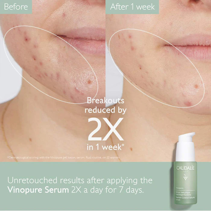 Vinopure Acne-Prone Skin Essentials