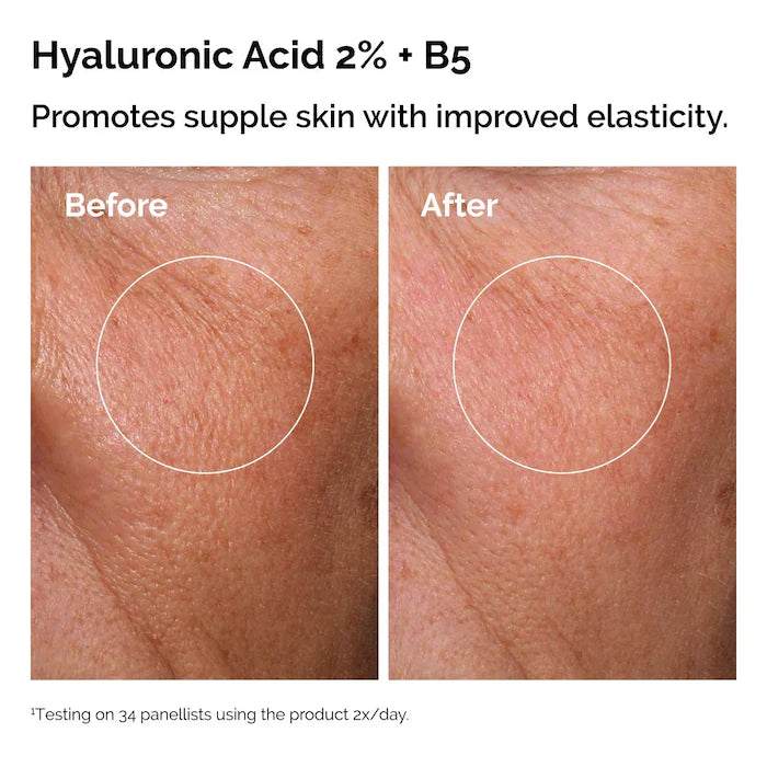 The Skin Support Set with Niacinamide + Hyaluronic Acid