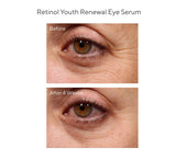 Youth Renewal Retinol Trial Kit for Smoother, Younger-Looking Skin