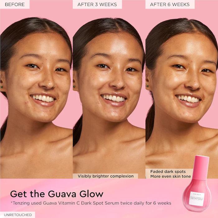 Guava Vitamin C Dark Spot Treatment Serum